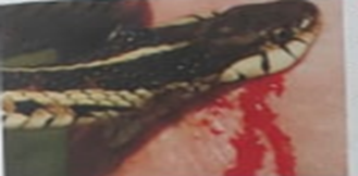 This YouTube video provides a comprehensive overview of safety measures and first aid procedures, making it an engaging resource for visual learners
